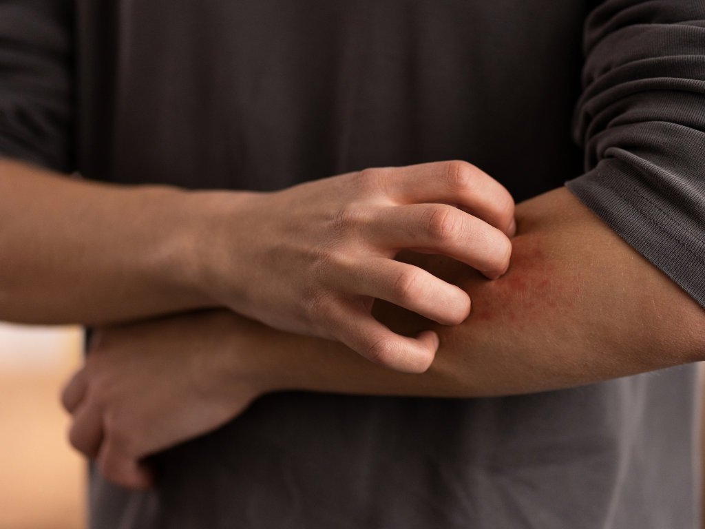 Person scratching irritated skin showing connection to gut health problems
