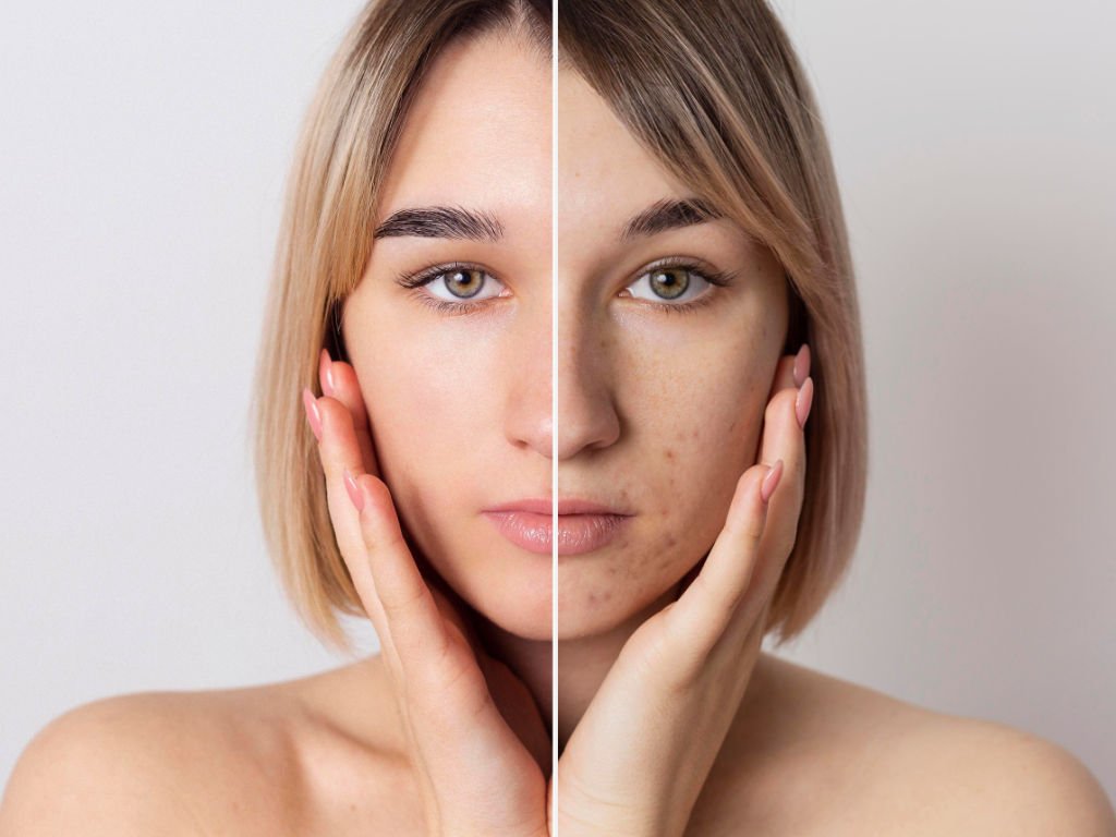 Before and after comparison showing turmeric skin benefits with clearer, more radiant complexion demonstrating realistic skincare transformation results